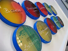 Dosen mit bunten Kulturen (Bakterien, Keime)